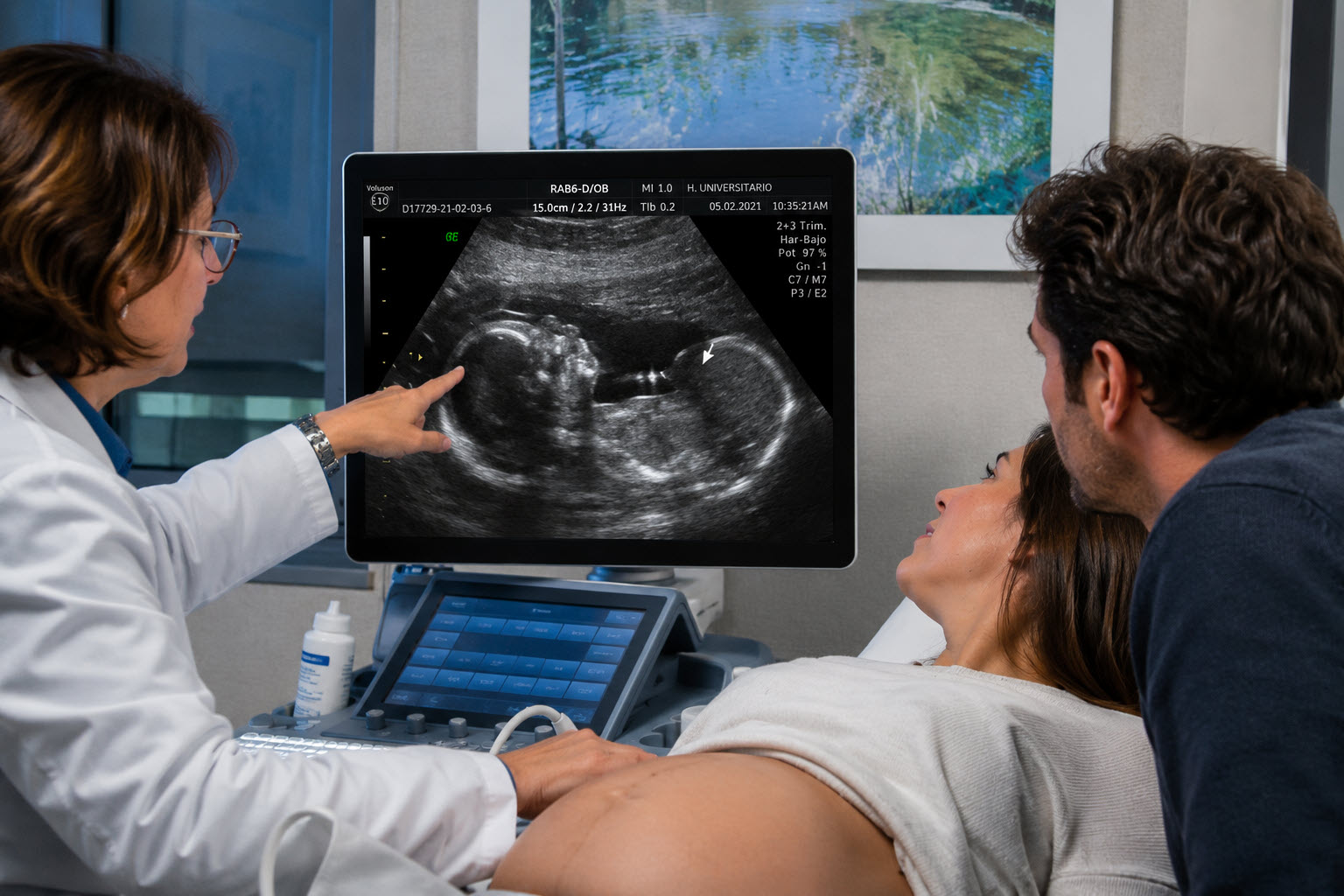 Diagnóstico prenatal de onfalocele mediante ecografía fetal